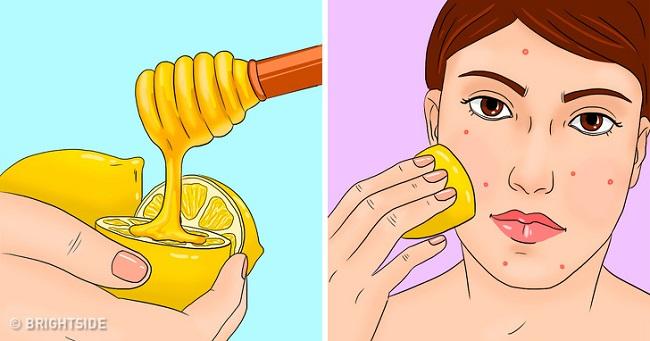 Trị mụn bằng chanh và mật ong: Đây là nguyên liệu trị mụn phổ biến và an toàn, ít gây kích ứng cho da, kể cả những làn da nhạy cảm nhất. Trộn đều hỗn hợp mật ong và nước cốt chanh, thoa lên da 2 lần/ tuần vừa giúp trị mụn, vừa loại bỏ vết thâm mụn và dưỡng da trắng sáng.
