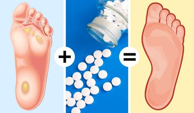 Loại bỏ vết chai nhờ thuốc aspirin: Trộn đều hỗn hợp 4 viên aspirin với nước cốt chanh và nước thành hỗn hợp sền sền rồi đắp lên vùng da bị chai, để đến khi khô lại rồi rửa sạch. Áp dụng 2 lần/ tuần để có kết quả tốt nhất.