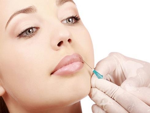 Giật mình hình ảnh đôi môi sưng phồng của người phụ nữ do tiêm filler làm đẹp