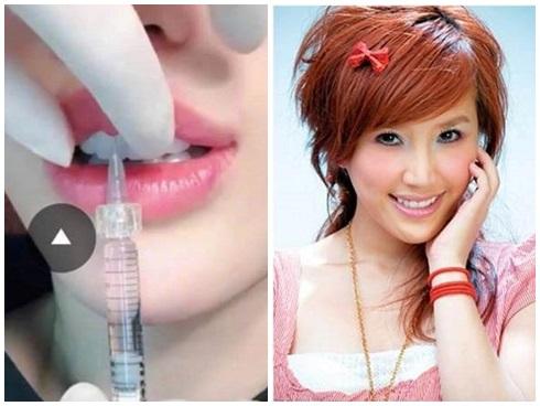 Sau phát ngôn thưởng 10 tỷ cho ai có bằng chứng chứng minh mình dao kéo, Bảo Thy nói gì?