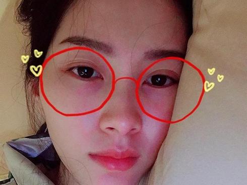 Tin sao Việt: Hoa hậu Thu Thảo than bị vẹo cổ phải nằm một chỗ