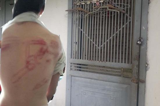 Truy tìm người cha dùng tuýp sắt đánh 2 con dã man ở phường Phúc Đồng, Long Biên, Hà Nội. Theo lời kể của hàng xóm, sự việc xảy ra vào ngày 1/6 vừa qua, sau khi đánh con người cha đã bỏ đi biệt tích. Hai đứa trẻ giờ đã được đưa về ở với bà nội tại Hải Dương. Chủ tịch UBND phường cho biết nghi can chỉ là người thuê trọ trên địa bàn, sau khi được tin báo, họ đã tới căn nhà để giải quyết nhưng nghi can đã bỏ trốn.