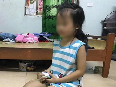 Chảy máu mũi ròng ròng, bình luận viên vẫn bình tĩnh dẫn chương trình trực tiếp-4