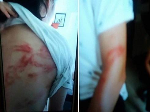 Vụ bố bị tố cáo bạo hành con đẻ: 'Tôi có dùng gậy nhôm đánh con'