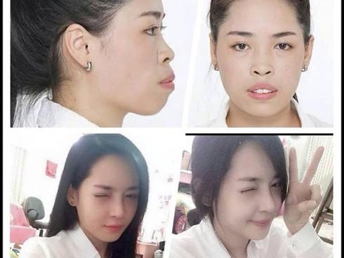 Đổi đời nhờ được tài trợ dao kéo 1 tỷ, hotgirl Nam Định ngày càng xinh đẹp tận hưởng cuộc sống như Rich Kid-16