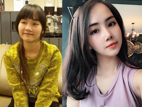 'Đập mặt xây lại' quá thành công, cô gái 23 tuổi kiếm ngay được tấm chồng như ý