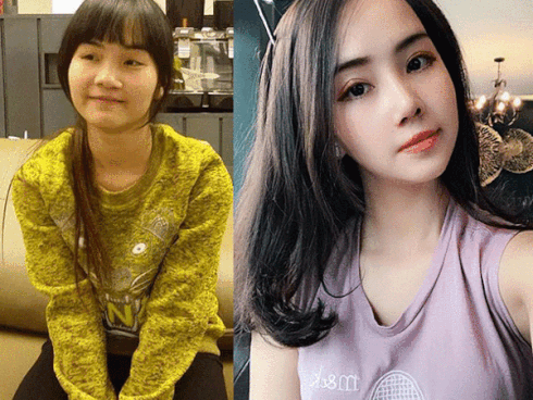 Cô gái bị chê là ma cà rồng lột xác sau 5 lần phẫu thuật thẩm mỹ-3