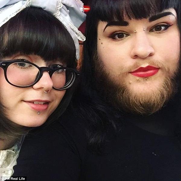 Mắc bệnh lạ, cô gái trẻ bị mọc râu lởm chởm khắp mặt-2