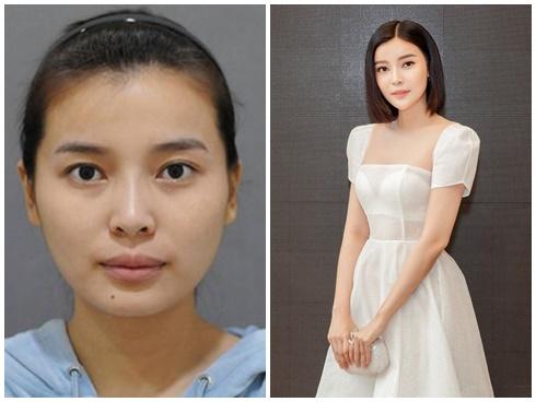 Vừa mới hot nhờ trúng vai Trung úy Minh Ngọc trong 'Hậu duệ mặt trời' Việt, Cao Thái Hà đã bị 'đào mộ' ảnh thời chưa thẩm mỹ