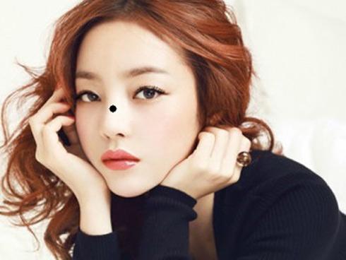 Những nốt ruồi may mắn, phát tài trên mặt, đừng tưởng xấu mà xóa bỏ để vận mệnh phải thay đổi