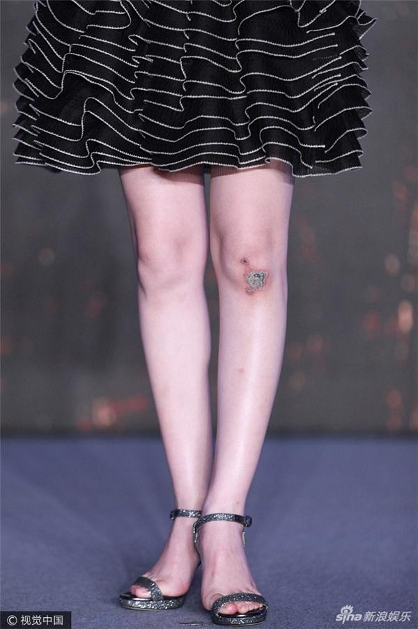 Triệu Lệ Dĩnh xác nhận bị suy tim, dân mạng chia sẻ loạt ảnh mỹ nhân Hoa Thiên Cốt gầy rộc ốm yếu như bộ xương khô-10