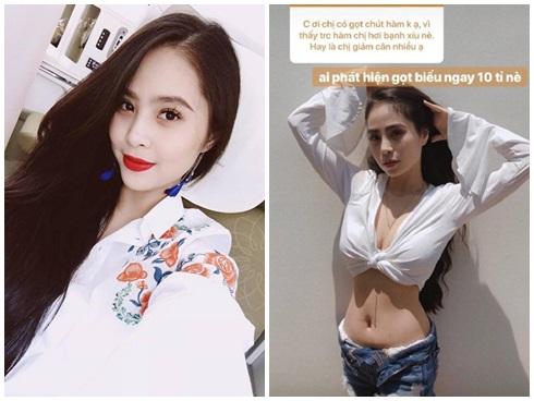 Ca nương Kiều Anh hùng hồn tuyên bố 'biếu ngay' 10 tỷ cho ai có bằng chứng cô gọt hàm