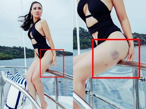 Da trắng sứ, body đẹp hơn xuân thì nhưng có ai nhìn thấy Thu Minh tím bầm chân trong bộ ảnh 'nóng rẫy'