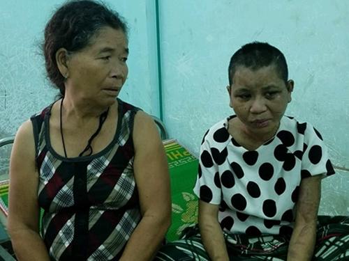 Vụ tra tấn người làm thuê: Bộ trưởng Lao động đề nghị khởi tố