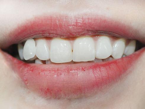 Cuộc đời bạn có bao nhiêu thăng trầm, sướng khổ buồn vui, nhìn hàm răng là biết