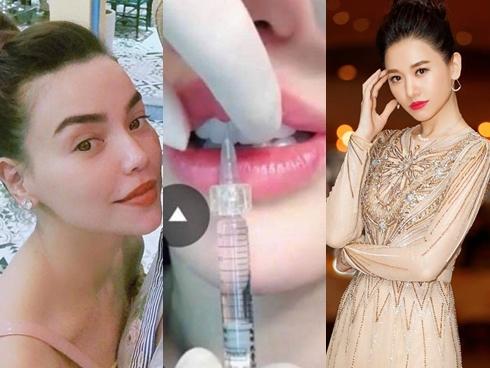 Những hình ảnh vẽ tạo hình, băng bó chằng chịt của sao Việt trên bàn phẫu thuật thẩm mỹ khiến người ta giật mình-24