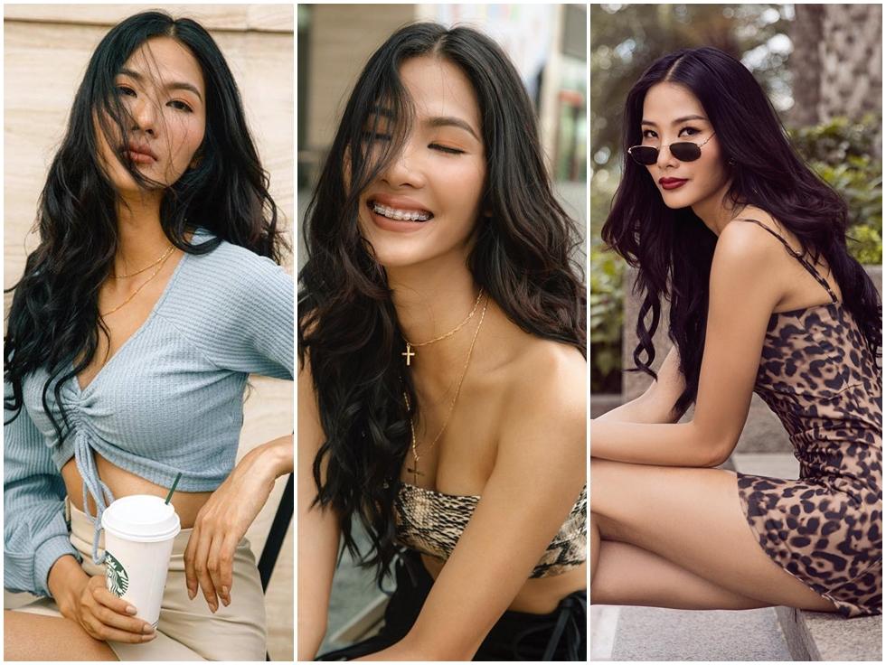 Ngỡ ngàng trước sự lột xác vi diệu nhờ niềng răng, dung mạo thay đổi 180 độ-10