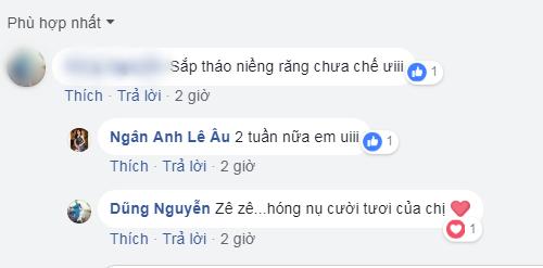 Đã tìm thấy lý do khiến đôi môi của Lê Âu Ngân Anh lúc nào cũng vểnh như có can thiệp dao kéo-6
