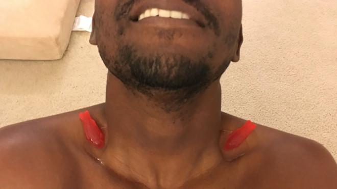 Rộ trào lưu thả cá vào xương quai xanh để đọ dáng chuẩn-1