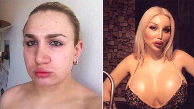 Chàng trai đập toàn thân xây lại tốn 3,3 tỷ để làm búp bê nữ-1