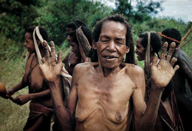 Hủ tục cắt ngón tay man rợ của bộ tộc Dani ở Indonesia-3