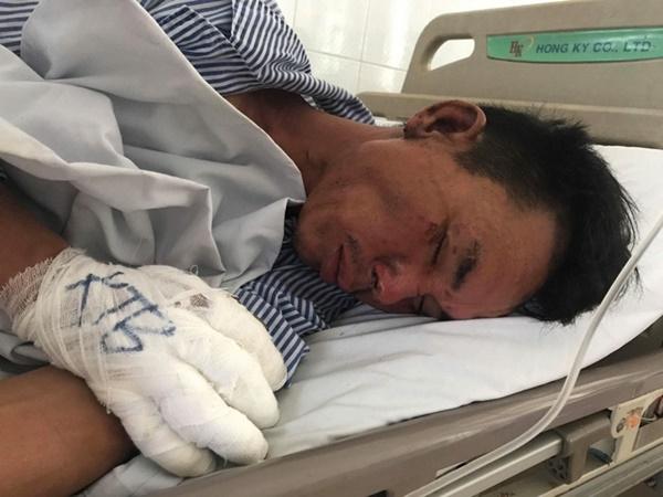 Con rể phóng hỏa, truy sát cả nhà vợ cũ-2