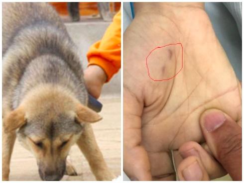 Bác sĩ cấp cứu kể nỗi ám ảnh, bất lực trước ánh mắt người sắp chết vì chó cắn