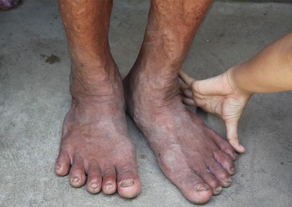 Lai lịch bí ẩn của dị nhân khổng lồ cao hơn 2m ở miền Tây-3