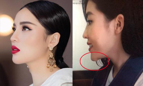 BỨC ẢNH HOT NHẤT TRONG NGÀY: Khẳng định đẹp nhờ bấm huyệt, Kỳ Duyên không may để lộ dấu vết lạ-4