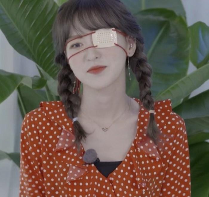 Pháo hoa bắn vào mắt, Wendy (Red Velvet) bị thương ngay thời điểm nhóm tái xuất-1