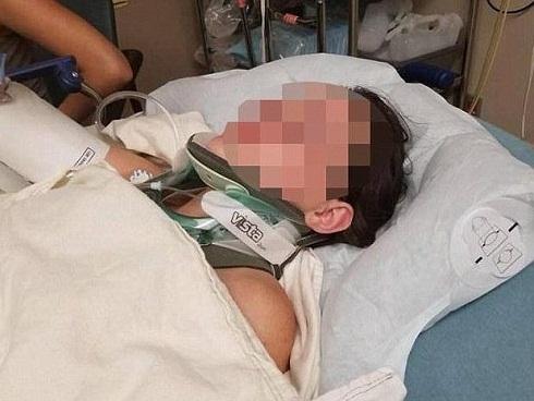 Nữ sinh gãy xương sườn, thủng phổi vì bị bạn xô ngã từ độ cao 20 m