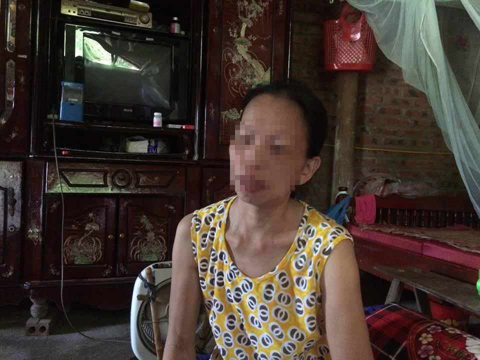 Phú Thọ: Cả xã xôn xao vì nhiều người bị nghi nhiễm HIV-2