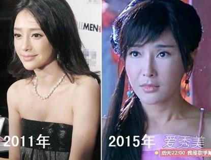 Phú Sát hoàng hậu Tần Lam trong Diên Hi Công Lược rõ ràng đẹp xuất sắc, nhưng sự thật trước khi dao kéo thì sao?-4