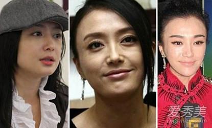 Phú Sát hoàng hậu Tần Lam trong Diên Hi Công Lược rõ ràng đẹp xuất sắc, nhưng sự thật trước khi dao kéo thì sao?-5