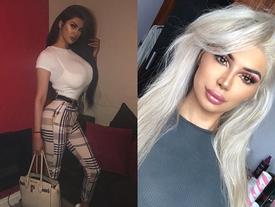 Chàng trai phẫu thuật chuyển giới để giống Kim 'siêu vòng 3' Chàng trai phẫu thuật chuyển giới để giống Kim 'siêu vòng 3'