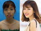 Từng có ý định tử tự vì bị ví 'Thị Nở thời hiện đại', cô gái đến từ Bắc Ninh quyết thẩm mỹ khiến người thân không nhận ra
