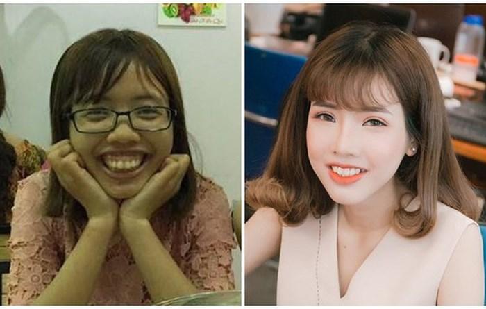 Từng có ý định tử tự vì bị ví Thị Nở thời hiện đại, cô gái đến từ Bắc Ninh quyết thẩm mỹ khiến người thân không nhận ra-1