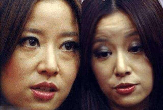 Loạt ảnh dìm hàng thê thảm chắc chắn Lâm Tâm Như cả đời cũng không bao giờ muốn nhìn lại-10