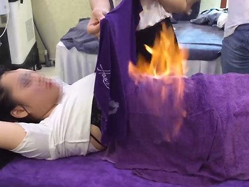 Cánh tay tong teo gây ám ảnh của cô gái trẻ sau 6 tháng giảm cân-4