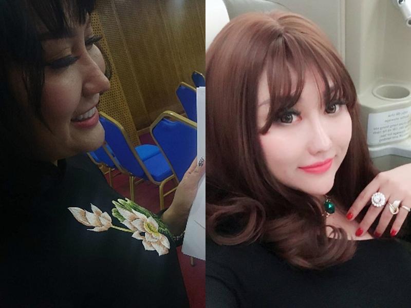 Phi Thanh Vân đang bị dao kéo hại khi xuất hiện mặt biến dạng, cằm nhọn hoắt lệch hẳn một bên-7