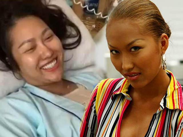 Phi Thanh Vân đang bị dao kéo hại khi xuất hiện mặt biến dạng, cằm nhọn hoắt lệch hẳn một bên-1