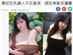 Hotgirl Hải Dương xuất hiện sau khi cắt bỏ 60% thể tích ngực-5