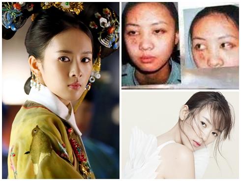 Phú Sát hoàng hậu của Như Ý truyện: ngọc nữ màn ảnh Đổng Khiết thân bại danh liệt vì mang danh dâm phụ-10