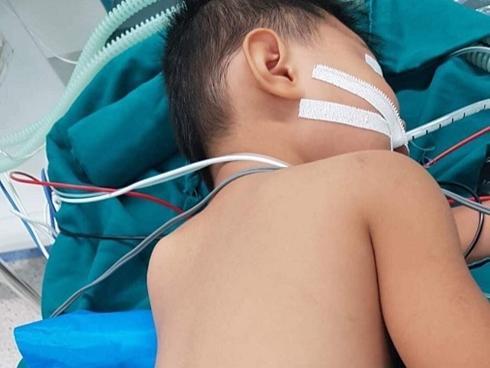 Nghịch súng hơi tự chế, bé trai 5 tuổi bị đạn xuyên thủng hông lưng