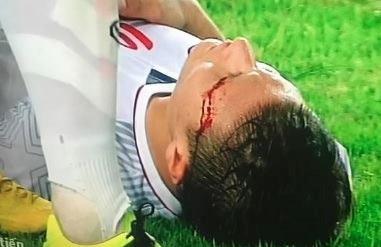 Bạn gái Quang Hải: Nhìn anh ngã bị chảy máu, em chỉ thấy xót-2