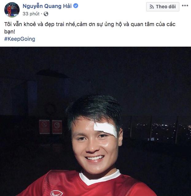 Máu chảy ròng ròng trên mắt, Quang Hải U23 an ủi người hâm mộ siêu lầy: Tôi vẫn khỏe và đẹp trai nhé-1