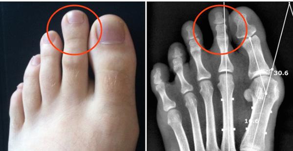 Tướng chân của người phụ nữ phú quý, cứ đi 1 bước là cuộc sống lại giàu có thêm 1 bậc-2