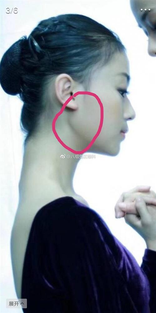 Ngụy Anh Lạc Ngô Cẩn Ngôn bị tố độn cằm, gọt mặt V-line, nhan sắc năm xưa khác xa bây giờ-2