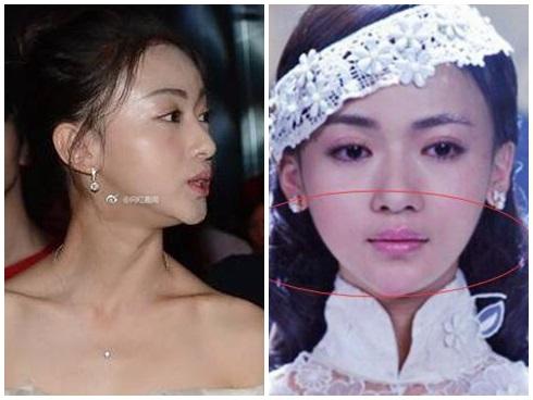 'Ngụy Anh Lạc' Ngô Cẩn Ngôn bị tố độn cằm, gọt mặt V-line, nhan sắc năm xưa khác xa bây giờ