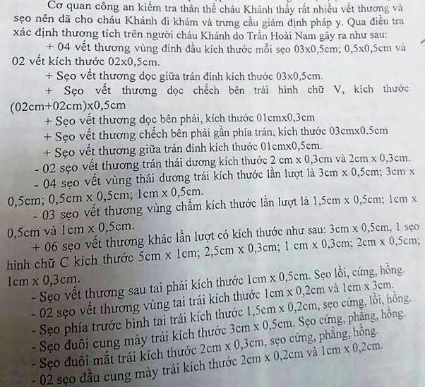 Xử vụ bé trai bị bố đẻ, mẹ kế hành hạ: Rùng mình nghe cáo trạng-3